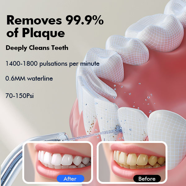 Y215 Water Dental Flosser White