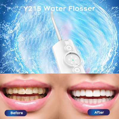 Bezvoi Y215 Professional Cordless Water Dental Flosser